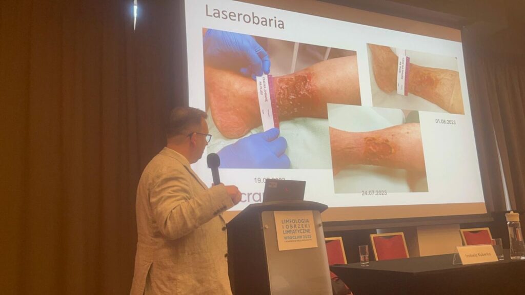 5th Conference of the Lymphology Section of the Polish Lymphology Society laserobaria Konrad Pańczak